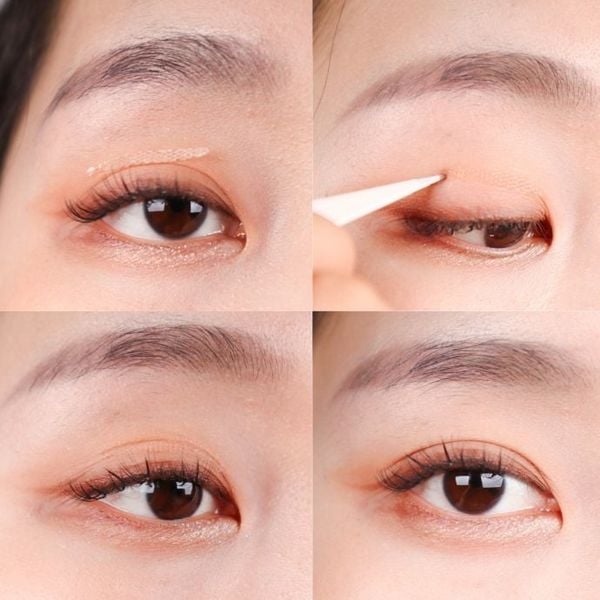 Miếng Dán Mí Lưới Ren Loại Thường