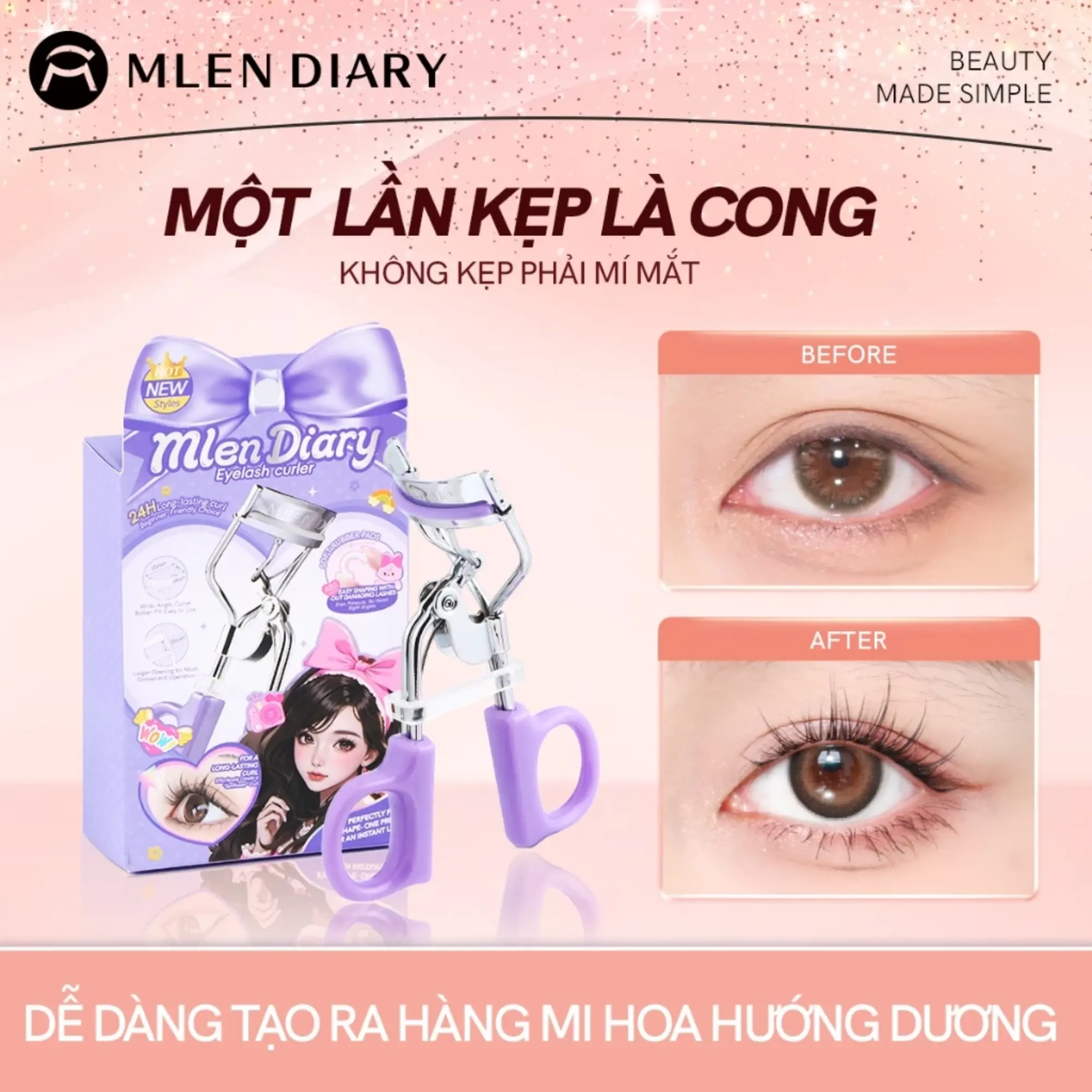 kẹp mi Mlen