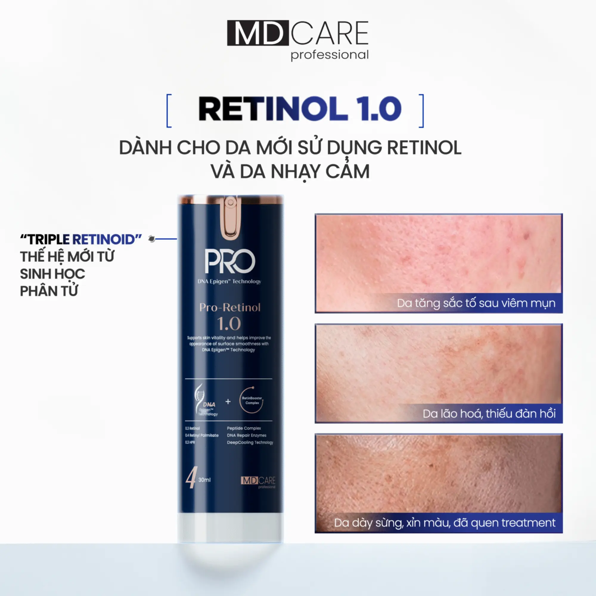 Kem dưỡng sáng da và cải thiện nếp nhăn Pro-Retinol 1.0