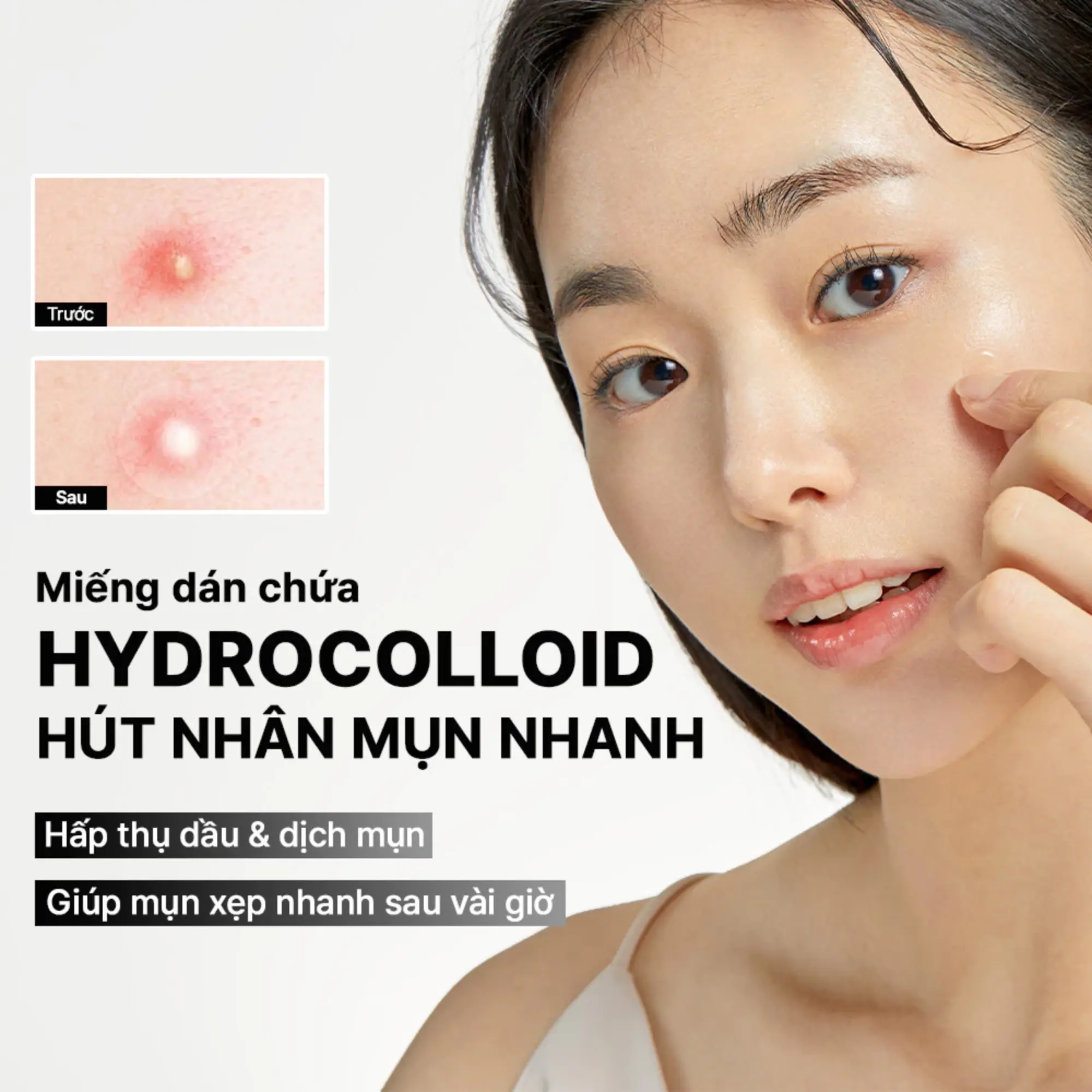 Miếng Dán Mụn Cosrx