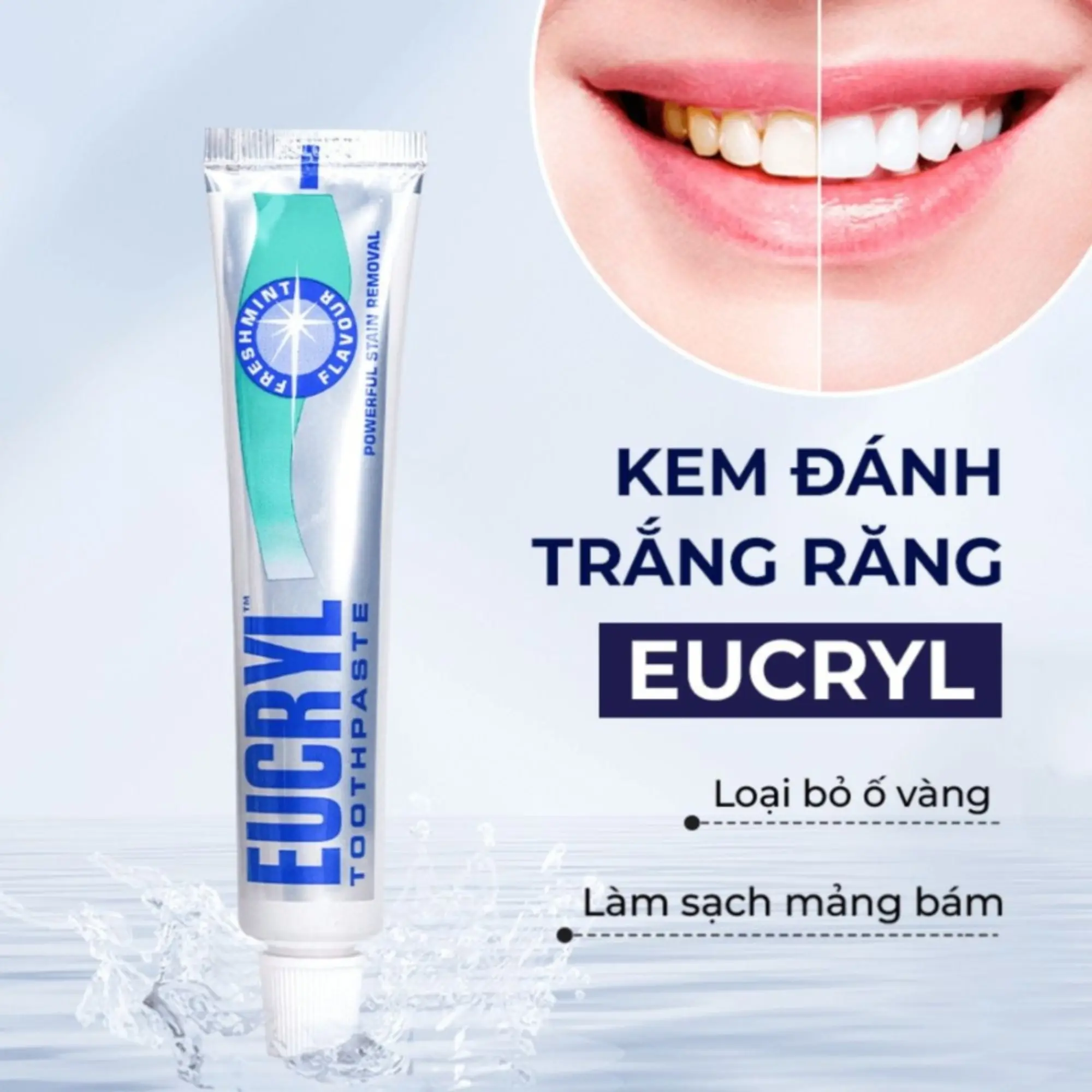kem đánh răng eucryl
