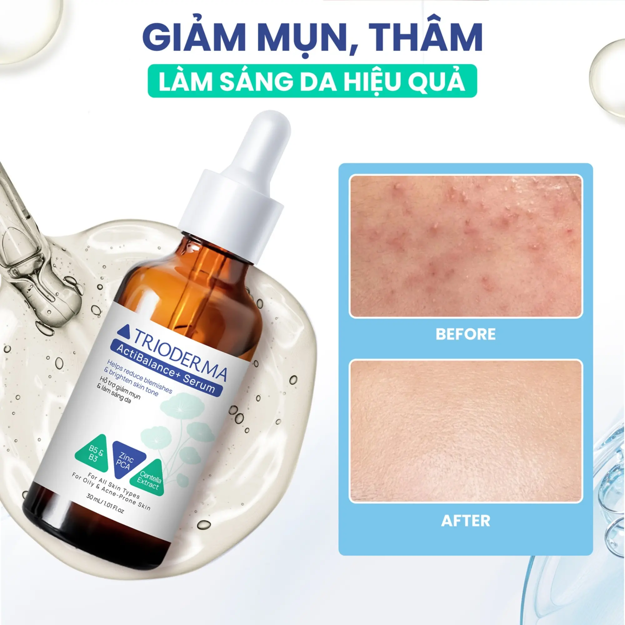Trioderma serum