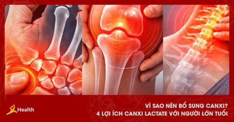Vì Sao Nên Bổ Sung Canxi? 4 Lợi Ích Của Calcium Lactate Với Người Lớn Tuổi