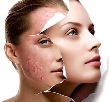Mặt nạ tái tạo da chuyên sâu: Mandelic Acid 27.5% kết hợp công nghệ tẩy tế bào chết thông minh