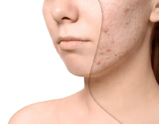 🌿 LẮNG NGHE LÀN DA SAU TỔN THƯƠNG Cica C·E Recovery Cream – Bản Giao Hưởng Của Phục Hồi Và Bảo Vệ