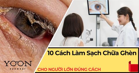 10 Cách Làm Sạch Và Chữa Ghèn Mắt Cho Người Lớn Đúng Cách
