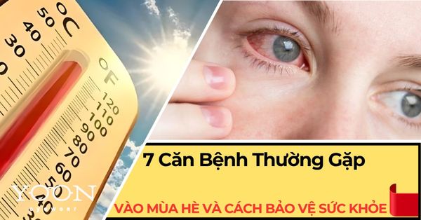 7 Căn Bệnh Thường Gặp Vào Mùa Hè Và Cách Bảo Vệ Sức Khỏe