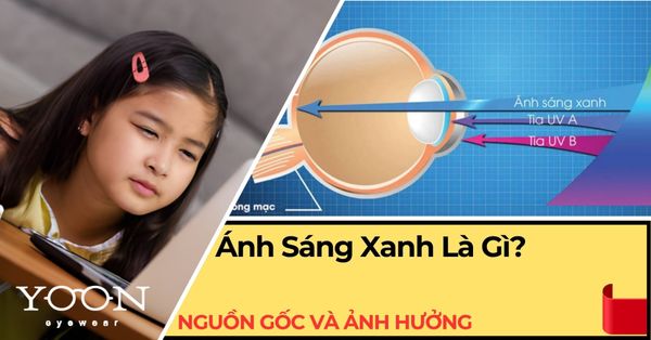 Ánh Sáng Xanh Là Gì? Nguồn Gốc Và Ảnh Hưởng Đến Mắt