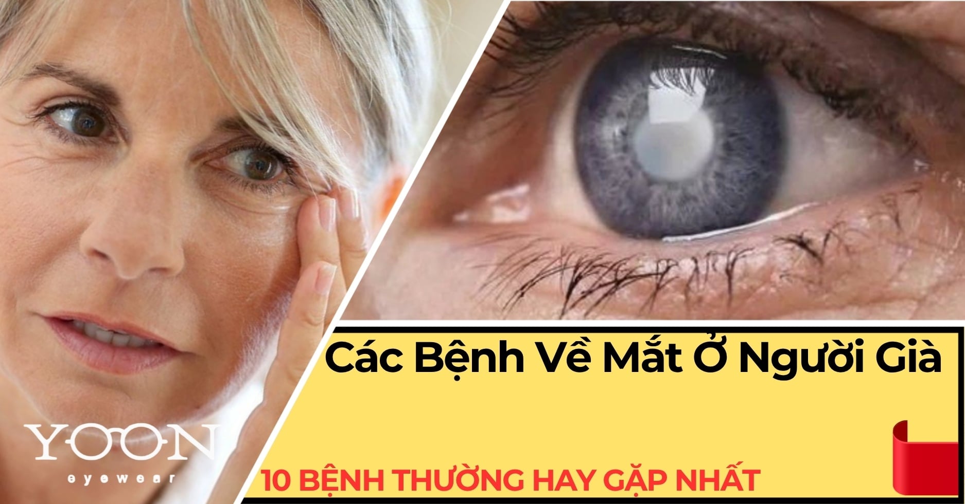 Các Bệnh Về Mắt Ở Người Già: 10 Bệnh Thường Gặp & Cách Phòng Ngừa