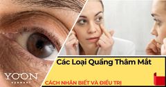 Các Loại Quầng Thâm Mắt: Cách Nhận Biết Và Phương Pháp Điều Trị