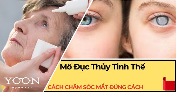 Cách Chăm Sóc Mắt Sau Khi Mổ Đục Thủy Tinh Thể Đúng Cách