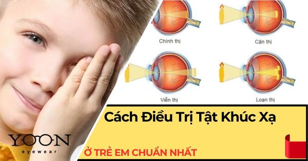 Cách Điều Trị Tật Khúc Xạ Ở Trẻ Em Chuẩn Nhất