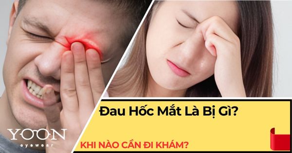 Đau Hốc Mắt Là Bị Gì? Khi Nào Cần Đi Khám?