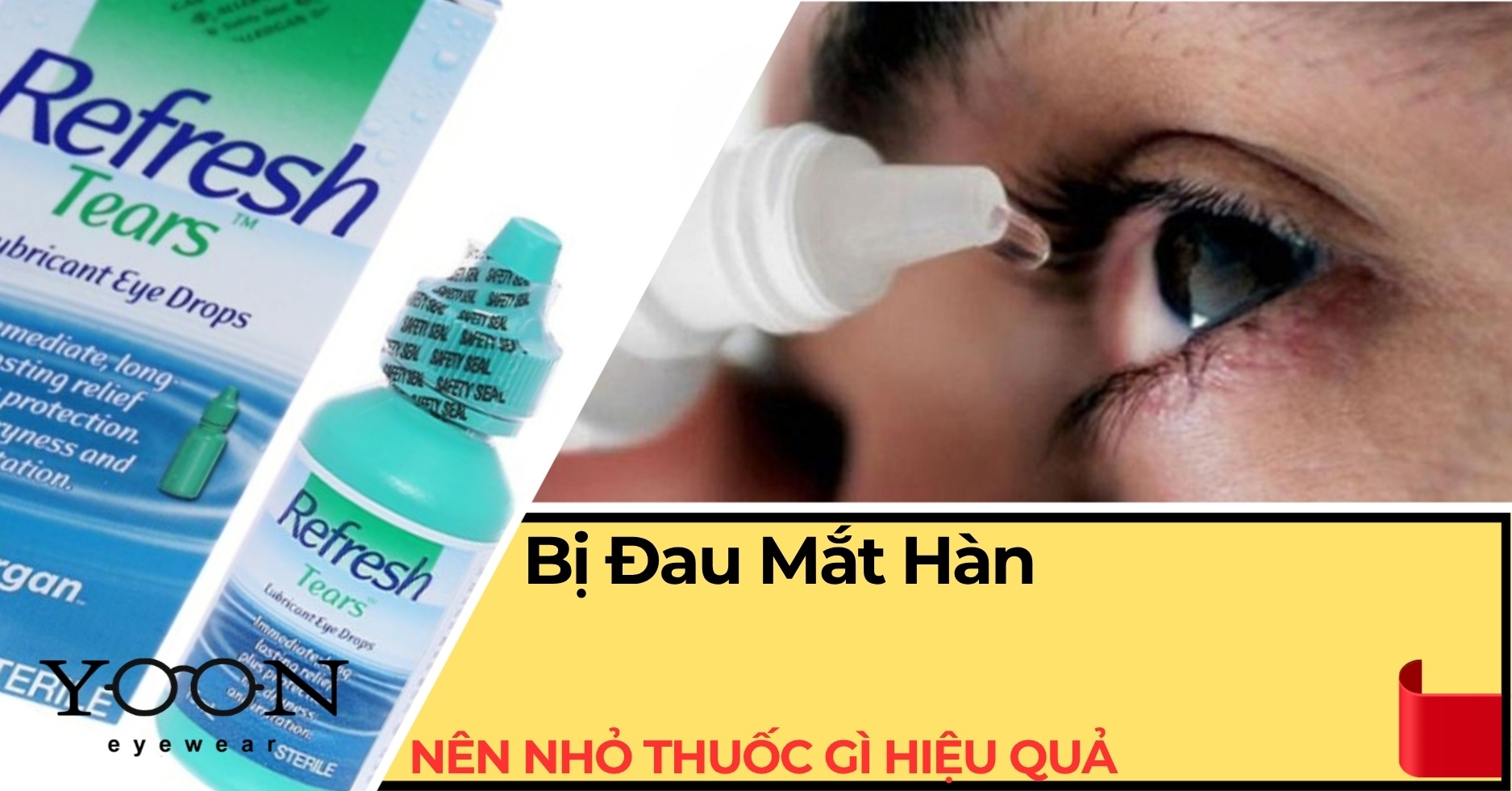 Đau Mắt Hàn Nhỏ Thuốc Gì Hiệu Quả? Những Điều Cần Biết
