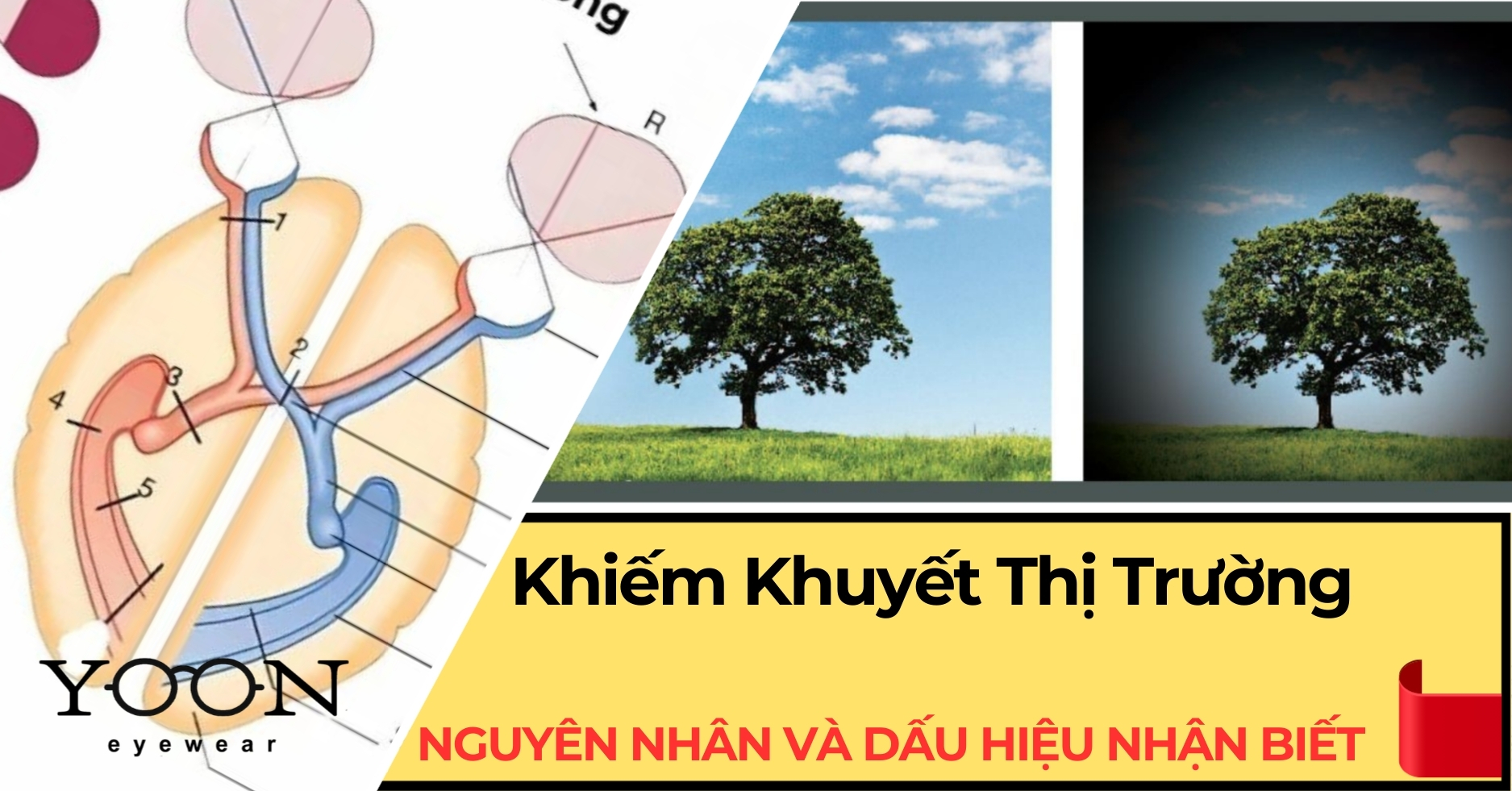 Khiếm Khuyết Thị Trường: Khái Niệm, Nguyên Nhân Và Triệu Chứng