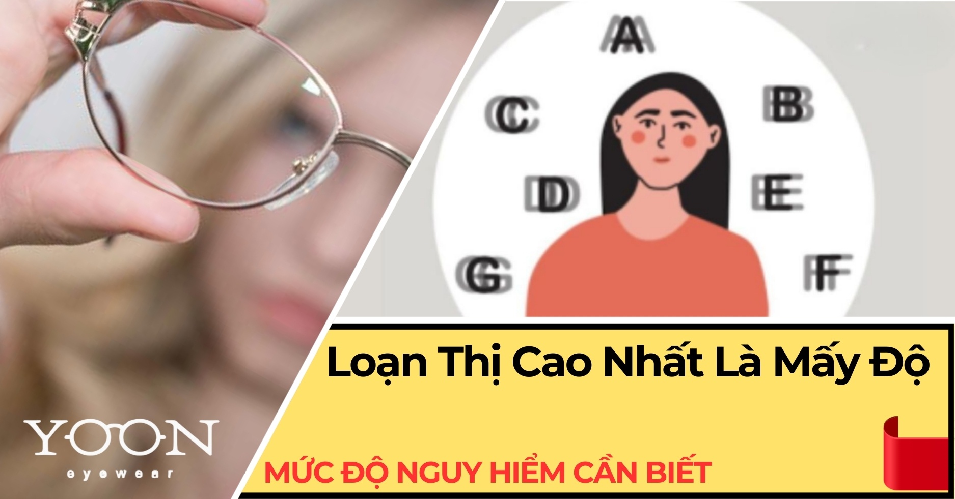 Loạn Thị Cao Nhất Là Mấy Độ? Mức Độ Nguy Hiểm Cần Biết
