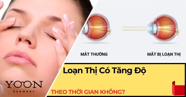Loạn Thị Có Tăng Độ Theo Thời Gian Không? Giải Đáp Chi Tiết