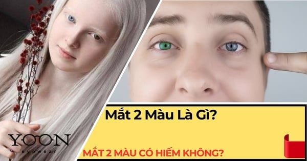 Mắt 2 Màu Ở Người: Hiện Tượng Hiếm Gặp Và Những Điều Thú Vị
