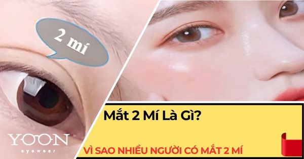 Mắt 2 Mí Là Gì? Vì Sao Nhiều Người Có Mắt Hai Mí