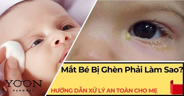 Mắt Bé Bị Ghèn Phải Làm Sao? Hướng Dẫn Xử Lý An Toàn Cho Mẹ