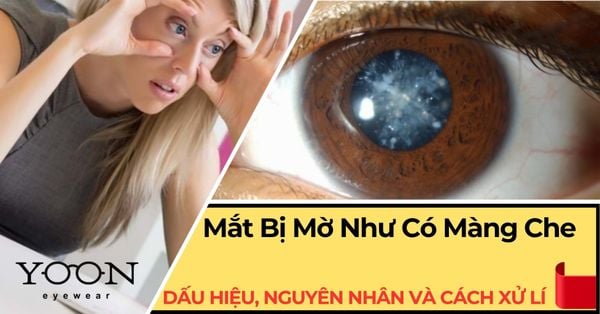 Mắt Bị Mờ Như Có Màng Che: Dấu Hiệu, Nguyên Nhân & Cách Xử Lý