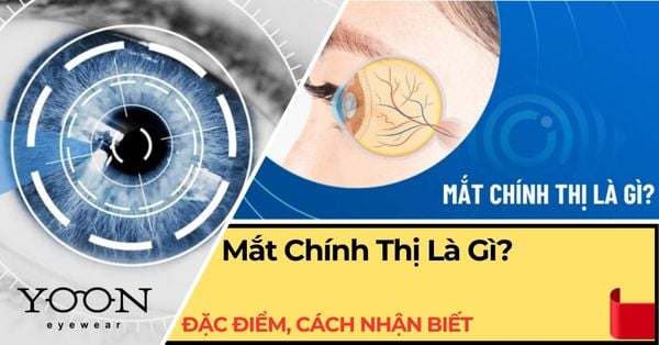 Mắt Chính Thị Là Gì? Đặc Điểm & Cách Nhận Biết