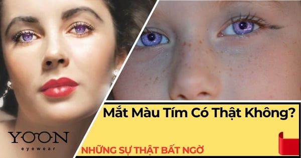 Mắt Màu Tím Có Thật Không? Sự Thật Khiến Nhiều Người Bất Ngờ