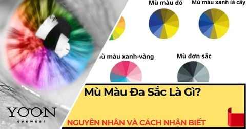 Mù Màu Đa Sắc Là Gì? Nguyên Nhân, Dấu Hiệu & Cách Nhận Biết
