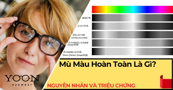 Mù Màu Hoàn Toàn (Achromatopsia): Nguyên Nhân Và Triệu Chứng