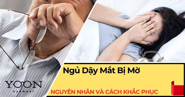 Ngủ Dậy Mắt Bị Mờ: Những Nguyên Nhân & Cách Khắc Phục Hiệu Quả