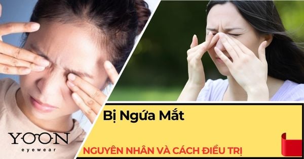 Ngứa Mắt: Nguyên Nhân Thường Gặp & Cách Điều Trị Hiệu Quả