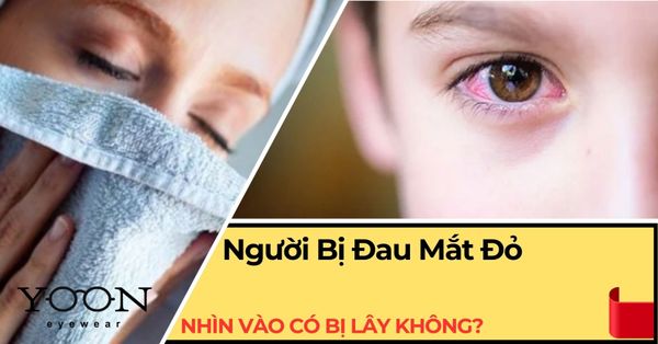 Nhìn Vào Người Đang Bị Đau Mắt Đỏ Có Lây Không?