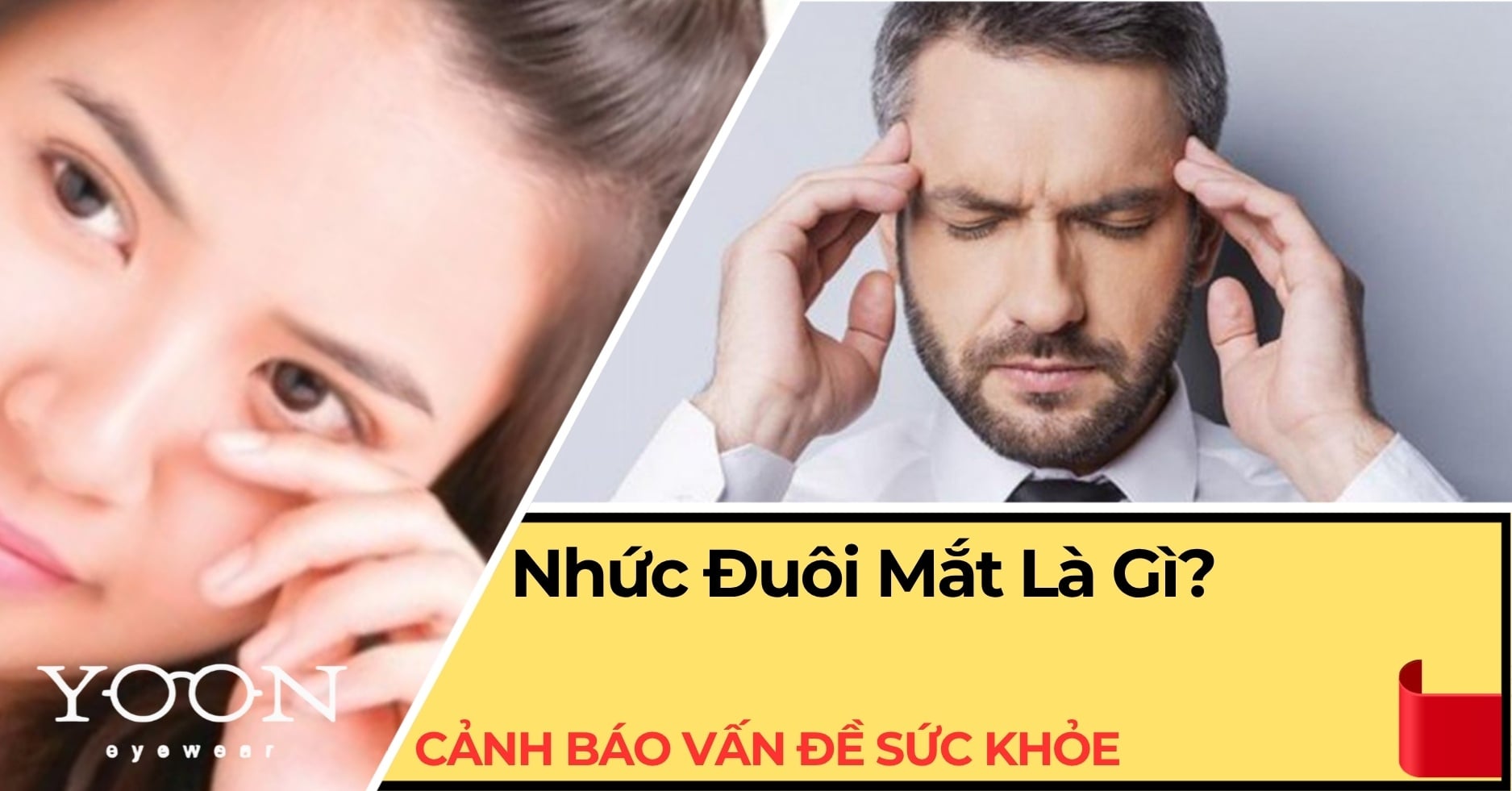 Nhức Đuôi Mắt Là Gì? Cảnh Báo Vấn Đề Sức Khỏe Mắt Không Nhỏ