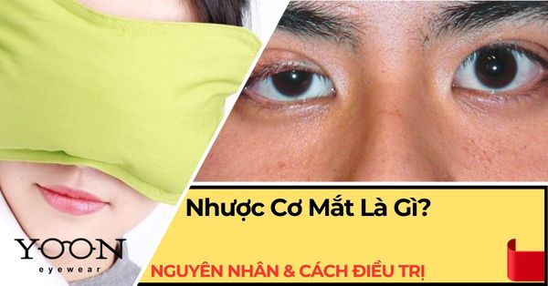 Nhược Cơ Mắt Là Gì? Dấu Hiệu, Nguyên Nhân & Cách Điều Trị