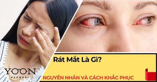 Rát Mắt Là Gì? Nguyên Nhân Và Cách Khắc Phục Hiệu Quả