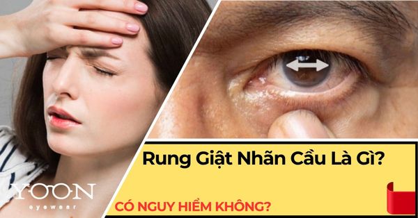 Rung Giật Nhãn Cầu Là Gì? Có Nguy Hiểm Không?