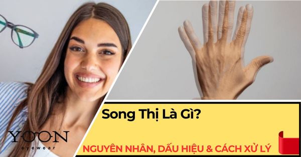 Song Thị Là Gì? Nguyên Nhân, Dấu Hiệu & Cách Xử Lý