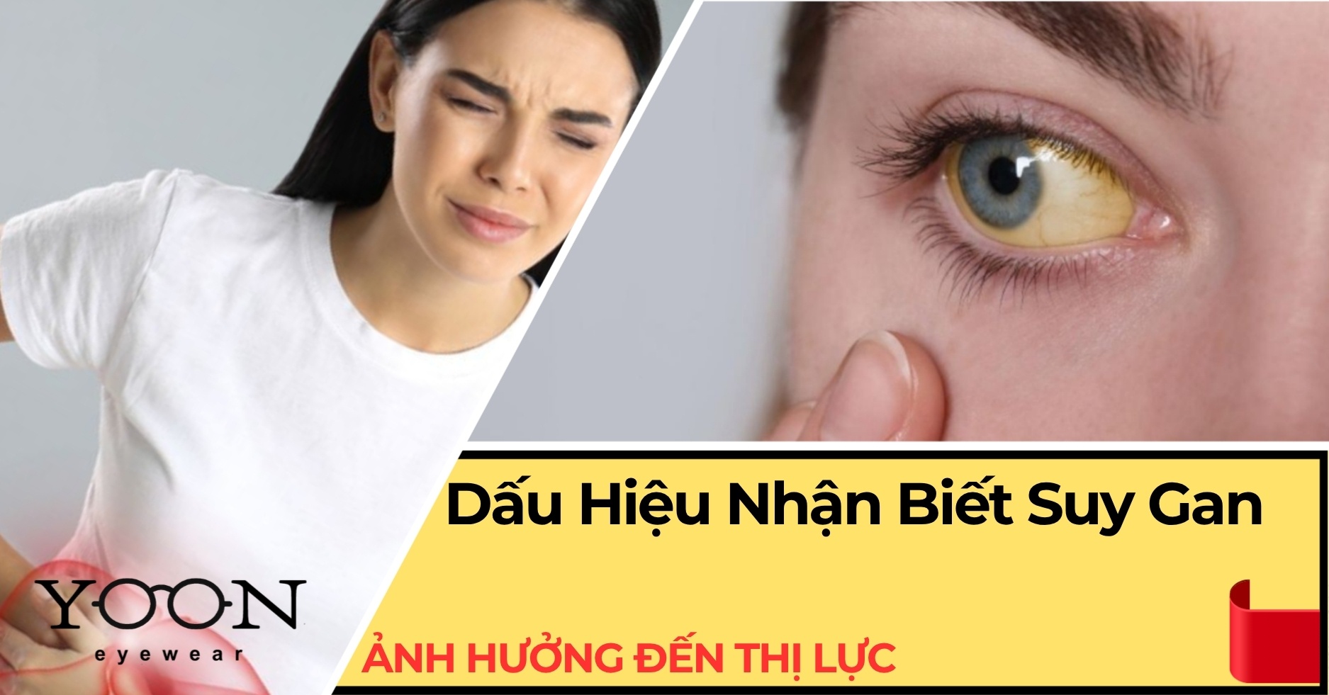Suy Gan Ảnh Hưởng Đến Thị Lực Như Thế Nào? Dấu Hiệu Cần Lưu Ý