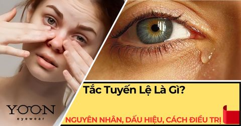 Tắc Tuyến Lệ Là Gì? Nguyên Nhân, Dấu Hiệu & Cách Điều Trị