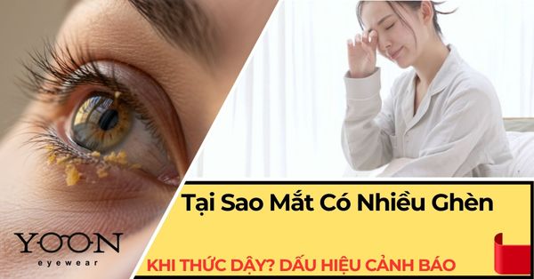 Tại Sao Mắt Có Nhiều Ghèn Khi Thức Dậy? Dấu Hiệu Cảnh Báo Bạn Nên Biết