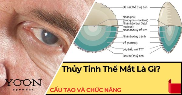 Thủy Tinh Thể Mắt Là Gì? Cấu Tạo, Chức Năng & Bệnh Thường Gặp