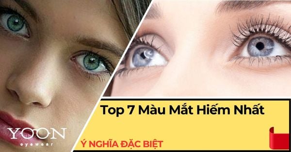 Top 7 Màu Mắt Hiếm Nhất Thế Giới Và Ý Nghĩa Đặc Biệt