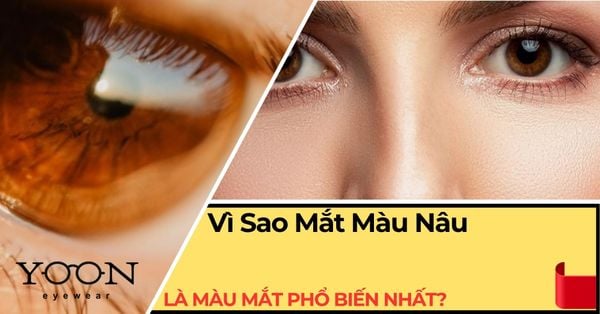 Vì Sao Mắt Màu Nâu Là Màu Mắt Phổ Biến Nhất?