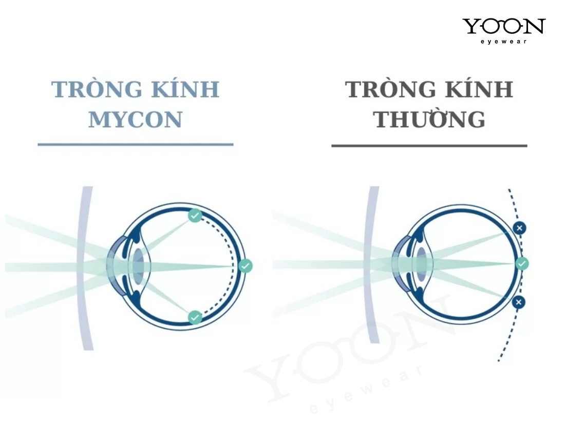 CƠ CHẾ HOẠT ĐỘNG - VÌ SAO CÓ THỂ KIỂM SOÁT TĂNG ĐỘ?