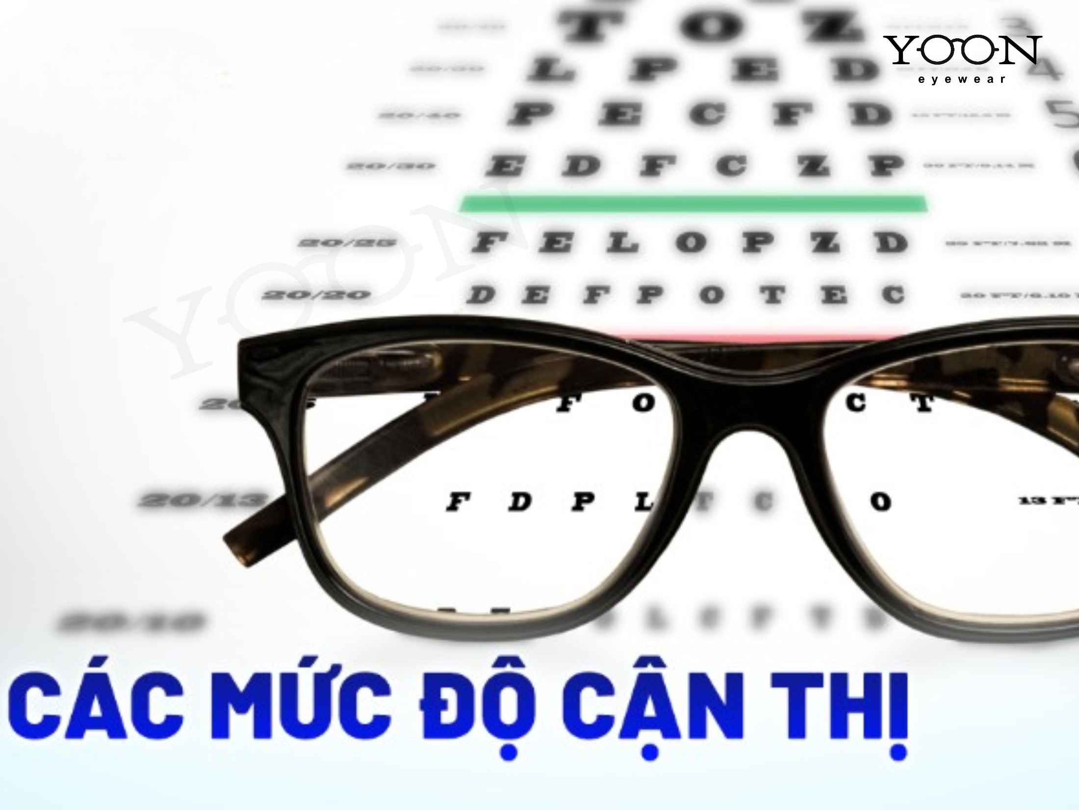 CÁC MỨC ĐỘ CẬN THỊ CỦA MẮT