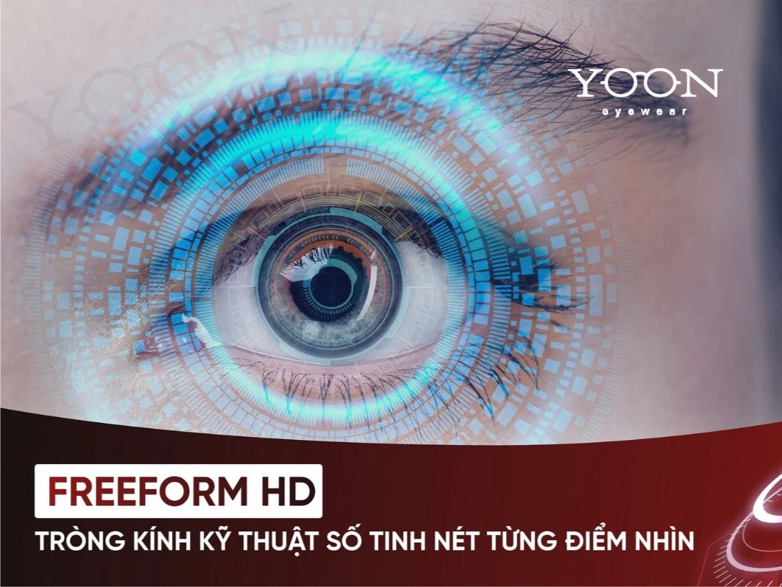 CÔNG NGHỆ FREEFORM HOẠT ĐỘNG NHƯ THẾ NÀO?
