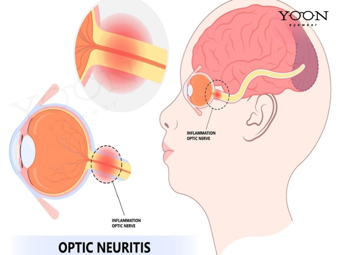 CHỨC NĂNG CỦA DÂY THẦN KINH THỊ GIÁC