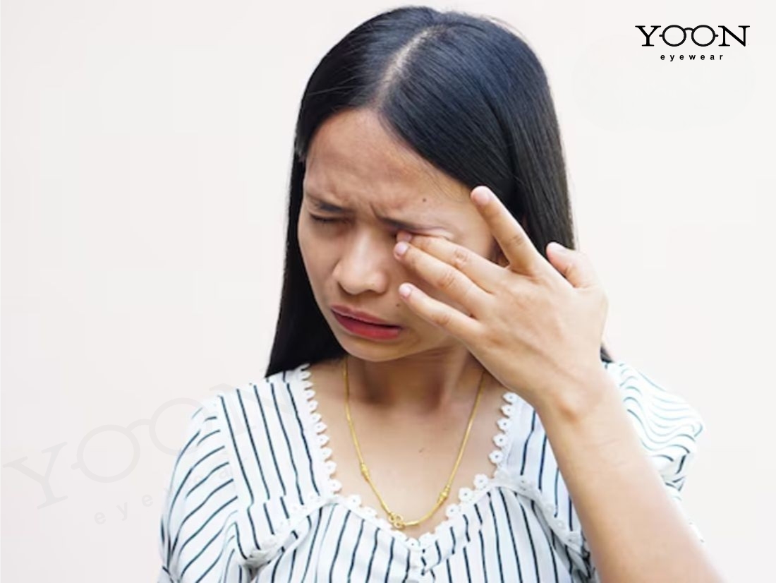 Dị Ứng Ở&nbsp;Mắt