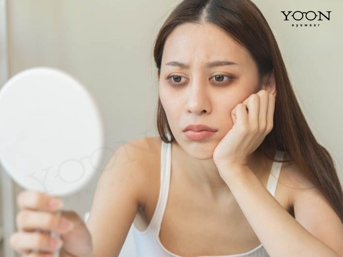 Do Tác Động Của Ánh Nắng Mặt Trời