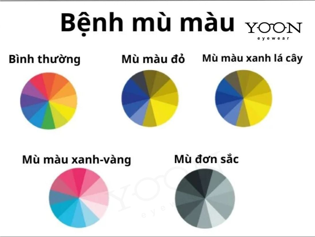 2. Mù Màu Xanh Dương – Vàng